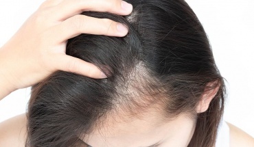 Αντιμετώπιση της τριχόπτωσης με μέσα που δεν φανταζόμασταν...