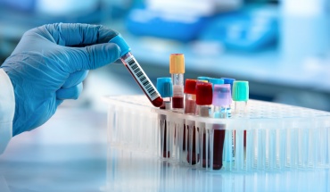 Νέα εξέταση αίματος υπόσχεται την ανίχνευση 18 τύπων καρκίνου