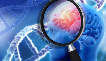 Παχυσαρκία και Νόσος Αλτσχάιμερ: Ποιοι βιολογικοί δείκτες τις συνδέουν