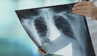 Τρύπες στην ηλεκτρονική υγεία: Εκτός φακέλων οι ακτινογραφίες ΓεΣΥ