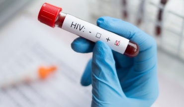 Πώς να τελειώνουμε με τον HIV μέχρι το 2030