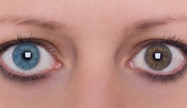 Ετεροχρωμία: Όσα πρέπει να γνωρίζετε για τη διαφορά στο χρώμα των ματιών