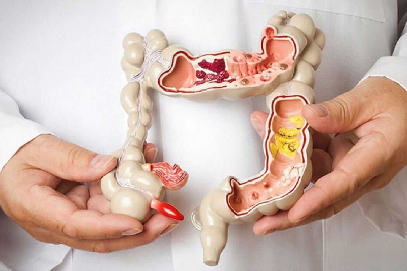 &Kappa;&alpha;&rho;&kappa;ί&nu;&omicron;&sigmaf; &pi;&alpha;&chi;έ&omicron;&sigmaf; &epsilon;&nu;&tau;έ&rho;&omicron;&upsilon; &sigma;&epsilon; &nu;έ&omicron;&upsilon;&sigmaf;: &Pi;&omicron;&iota;&alpha; &sigma;&upsilon;&mu;&pi;&tau;ώ&mu;&alpha;&tau;&alpha; &nu;&alpha; &mu;ά&sigmaf; &beta;ά&zeta;&omicron;&upsilon;&nu; &sigma;&epsilon; &upsilon;&pi;&omicron;&psi;ί&alpha;