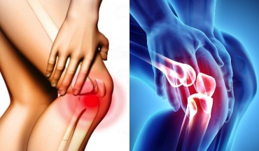 Η άσκηση χωρίς τραυματισμούς δεν δημιουργεί οστεοαρθρίτιδα γόνατος