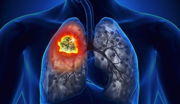 Οι καπνιστές κινδυνεύουν περισσότερο από λοιμώξεις τύπου COVID-19