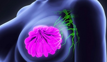 Αλλαγή στην αντιμετώπιση καρκίνου του μαστού με τη μελέτη PIONEER