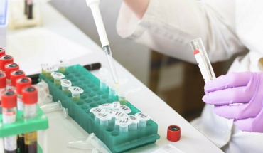 Ευλογιά των πιθήκων: Ανεβάζει τα επίπεδα συναγερμού η Ευρώπη