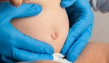 Ομφαλοκήλη: Αίτια, συμπτώματα, παράγοντες κινδύνου και θεραπεία