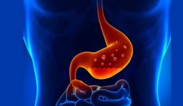 Γιορτές χωρίς καούρα και δυσπεψία: Τι πραγματικά βοηθάει