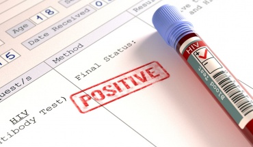 ΠΟΥ: Να αυξηθούν οι εξετάσεις για HIV και να αντιμετωπιστεί το στίγμα