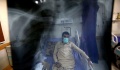 ΠΟΥ: Μακριά η επίτευξη των στόχων για το τέλος της φυματίωσης