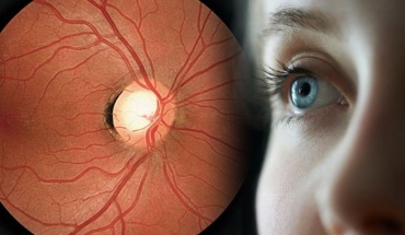 Φάρμακα για το διαβήτη προστατεύουν και τα μάτια μας