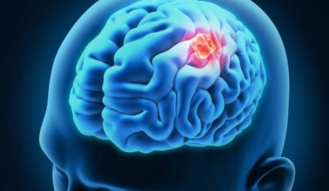 Μπορεί το Prozac να καταπολεμήσει τον καρκίνο του εγκεφάλου;