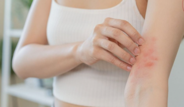 Το έκζεμα δυσκολεύει τη ζωή των νέων σε όλα τα μήκη και πλάτη της Γης