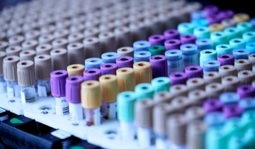 Επιθυμείτε να μάθετε πόσα χρόνια θα ζήσετε; Μία απλή εξέταση αίματος μπορεί να δώσει την απάντηση