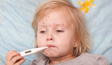 Η ιλαρά αποτελεί μία αυξανόμενη απειλή σε παγκόσμιο επίπεδο