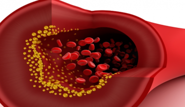 Μία απλή εξέταση αίματος μπορεί να ανιχνεύσει καρδιακές παθήσεις