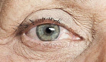 Πώς αντιμετωπίζεται το γλαύκωμα χωρίς φάρμακα;