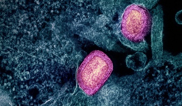 Νέα παραλλαγή της ευλογιάς των πιθήκων στη Μεγάλη Βρετανία