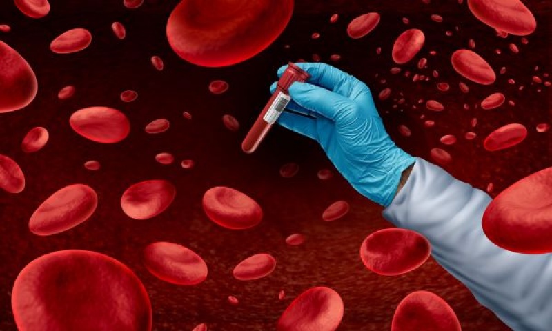 Έκθεση Προόδου της AACR 2025 για τις αιματολογικές κακοήθειες