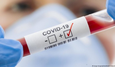 Καταγράφηκαν 771.145 κρούσματα COVID-19 το τελευταίο 24ωρο παγκοσμίως