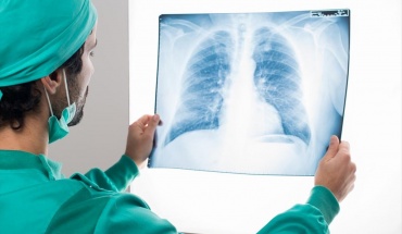 Η Αμερικανική Αντικαρκινική Εταιρεία επικαιροποιεί τη σύσταση για έλεγχο καρκίνου του πνεύμονα