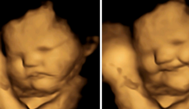 Τα έμβρυα αντιδρούν με εκφράσεις προσώπου στη διατροφή της εγκύου