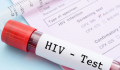 Πτώση στις εξετάσεις HIV στη Νότια Αφρική