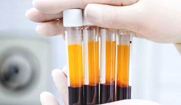 Επούλωση τραυμάτων με τη βοήθεια βλαστοκυττάρων από θύλακες τριχών