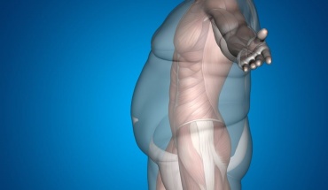 Κατευθυντήριες Οδηγίες Πρακτικής για τη Διαχείριση της Παχυσαρκίας