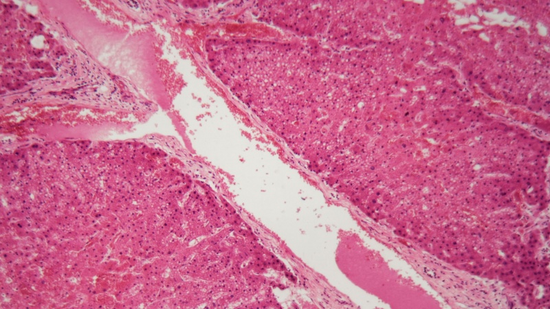 &Pi;&alpha;&nu;&epsilon;&lambda;&lambda;ή&nu;&iota;&omicron; &Sigma;&upsilon;&nu;έ&delta;&rho;&iota;&omicron; &kappa;&alpha;&iota; &Pi;&alpha;&gamma;&kappa;ό&sigma;&mu;&iota;&alpha; &Eta;&mu;έ&rho;&alpha; &Sigma;&pi;ά&nu;&iota;&omega;&nu; &Pi;&alpha;&theta;ή&sigma;&epsilon;&omega;&nu;: &Epsilon;&xi;&epsilon;&lambda;ί&xi;&epsilon;&iota;&sigmaf; &sigma;&tau;&eta;&nu; &alpha;&mu;&upsilon;&lambda;&omicron;&epsilon;ί&delta;&omega;&sigma;&eta;