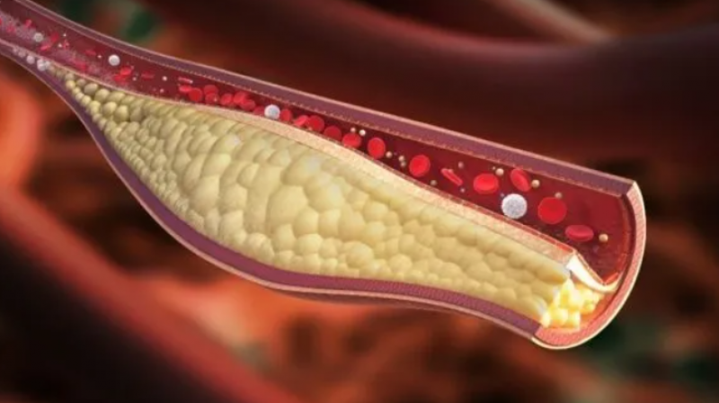 &Pi;&iota;&omicron; &epsilon;&pi;&iota;&rho;&rho;&epsilon;&pi;&epsilon;ί&sigmaf; &omicron;&iota; &gamma;&upsilon;&nu;&alpha;ί&kappa;&epsilon;&sigmaf; &sigma;&tau;&alpha; &kappa;&alpha;&rho;&delta;&iota;&alpha;&gamma;&gamma;&epsilon;&iota;&alpha;&kappa;ά &alpha;&kappa;ό&mu;&alpha; &kappa;&iota; &alpha;&nu; &delta;&epsilon;ί&chi;&nu;&omicron;&upsilon;&nu; &chi;&alpha;&mu;&eta;&lambda;&omicron;ύ &kappa;&iota;&nu;&delta;ύ&nu;&omicron;&upsilon;