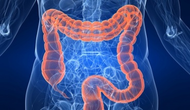 Ο καρκίνος παχέος εντέρου είναι κύρια αιτία θανάτου σε άτομα κάτω των 50