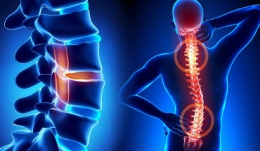 Τι να κάνουμε κάθε πρωί για να γλιτώσουμε από τους πόνους στη μέση