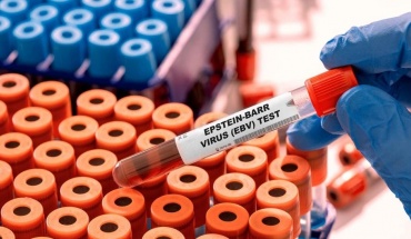 Ετοιμάζεται το πρώτο εμβόλιο κατά του ιού Epstein-Barr