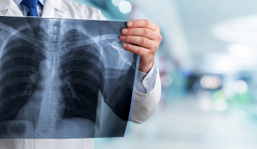 Πότε απαιτείται και πότε όχι ακτινολόγος – Η θέση της ΟΣΑΚ