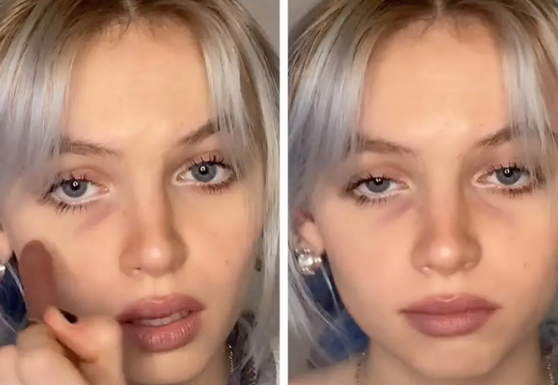 Tired Girl: Η τελευταία "ομορφιάς" τάσ&